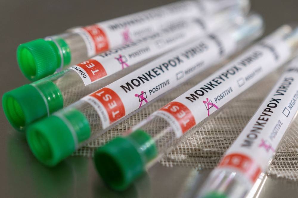 Test tubes labelled ‘Monkeypox virus positive’ are seen in this illustration taken May 22, 2022. — Reuters pic