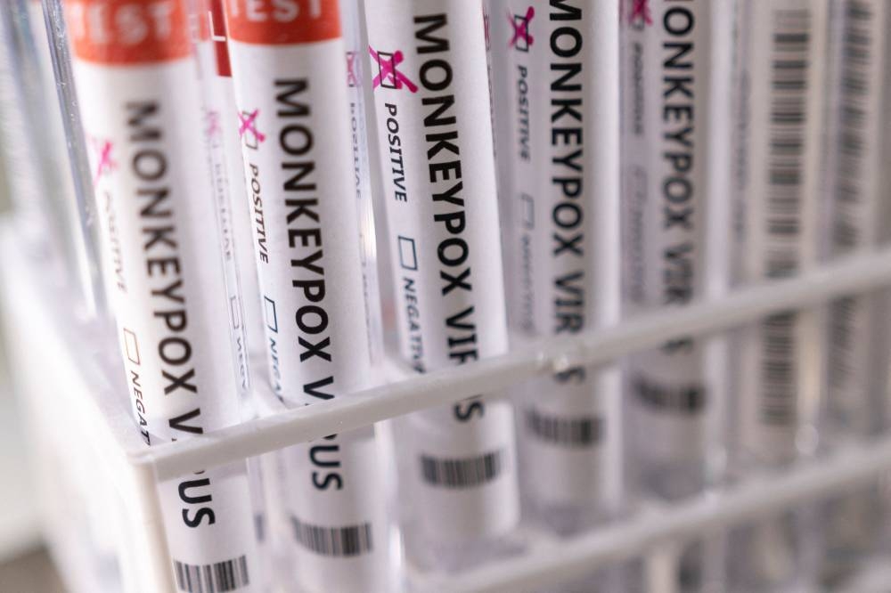 Test tubes labelled ‘Monkeypox virus positive’ are seen in this illustration taken May 22, 2022. — Reuters pic