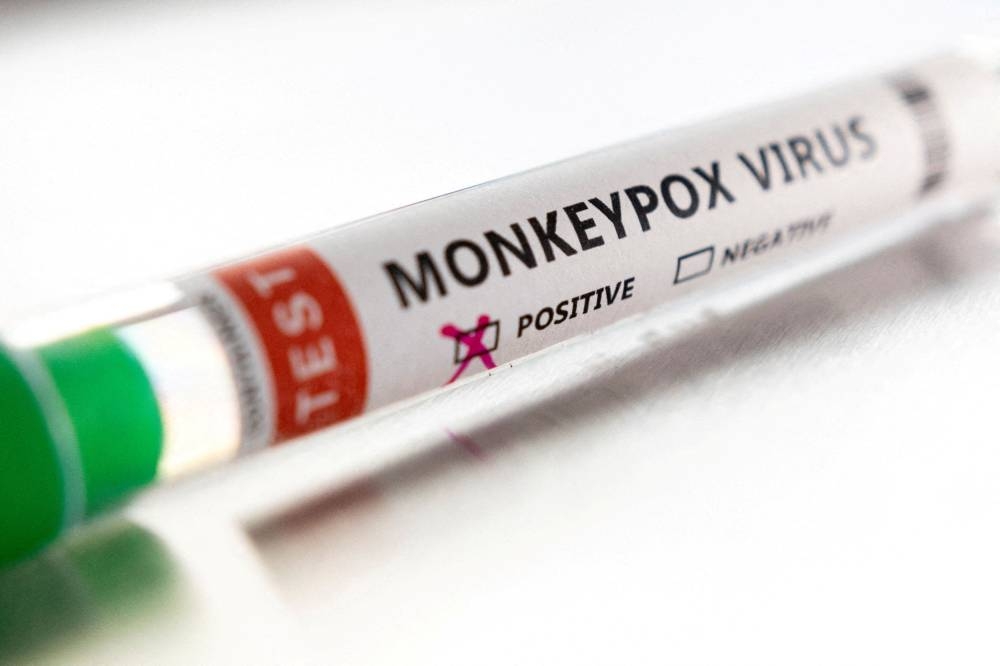 Test tube labelled ‘Monkeypox virus positive’ is seen in this illustration taken May 22, 2022. — Reuters pic