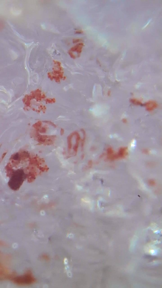 The Sanguina nivaloides algae, also known as ‘snow blood’ and which presence accelerates snowmelt, are seen in this handout picture released by the Cell and Plant Physiology Laboratory and taken at the Brevent in Chamonix, France, June 14, 2022. — Eric Marechal/Alpalga handout pic via Reuters