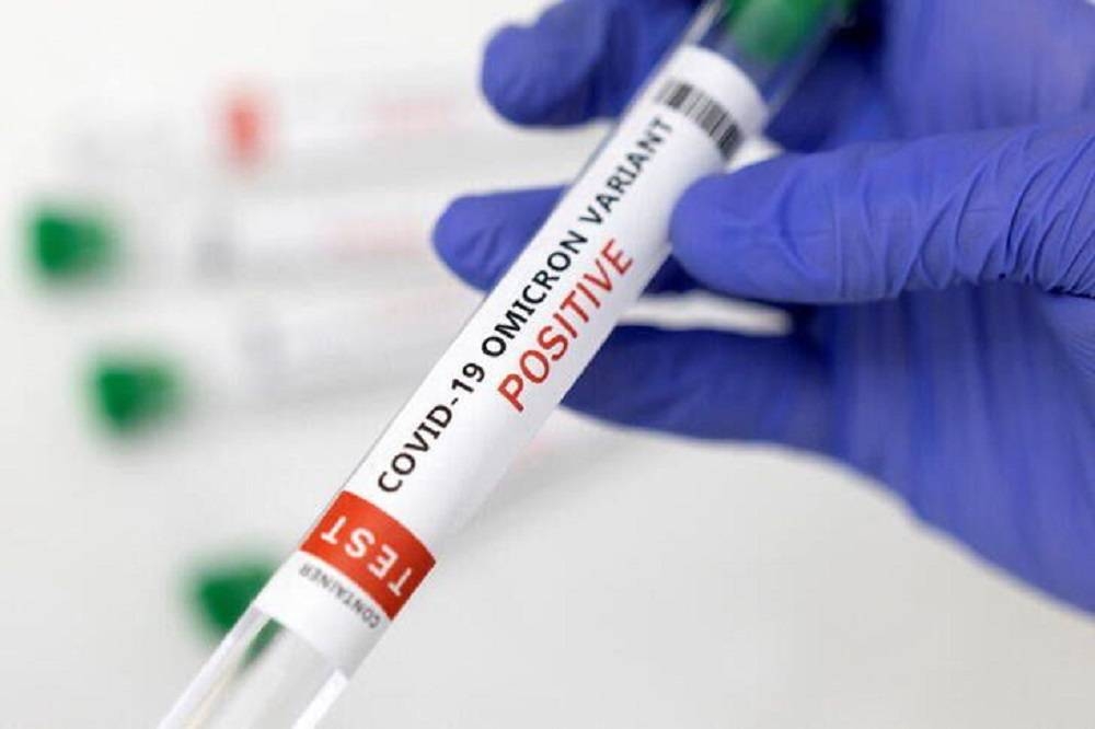 Test tube labelled ‘COVID-19 Omicron variant test positive’ is seen in this illustration picture taken January 15, 2022. — Reuters pic