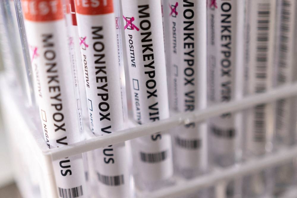 Johor Health Dept: 14 casual contacts of Malaysian in Singapore infected with monkeypox free of disease - Vimarsana News