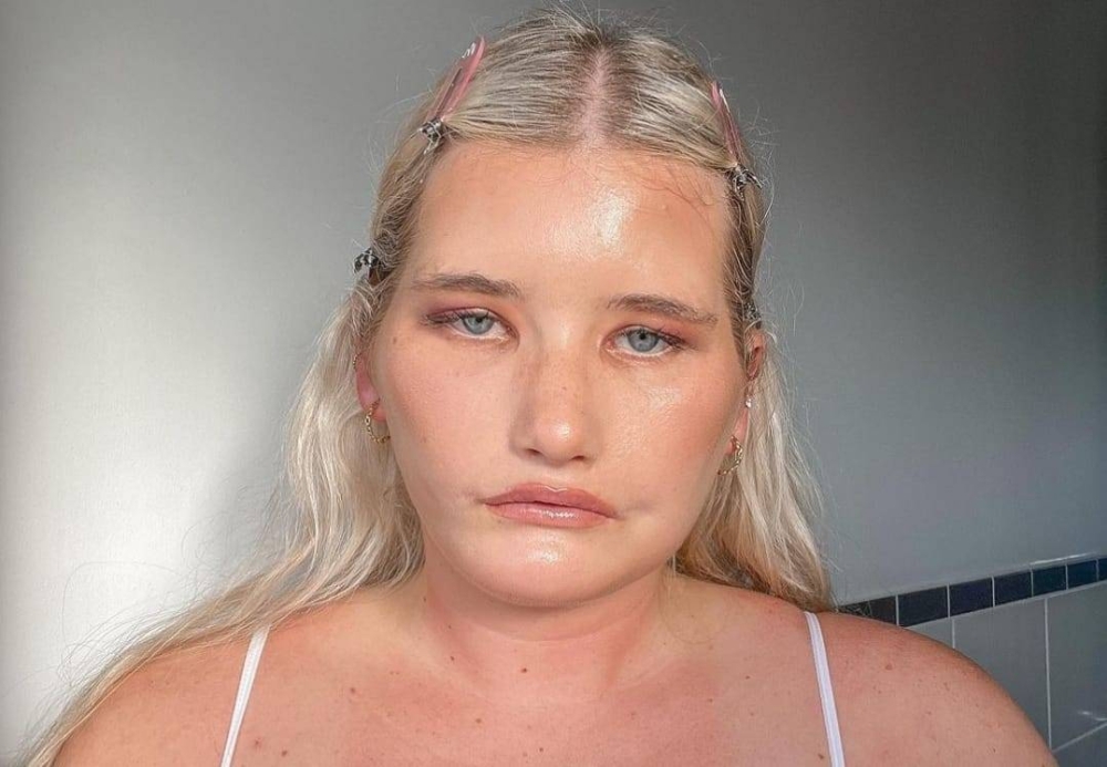 Tayla Clement Despite suffering from a neurological disorder,  Tayla Clement from reaching for the stars. — Picture via Instagram/ taylaclement