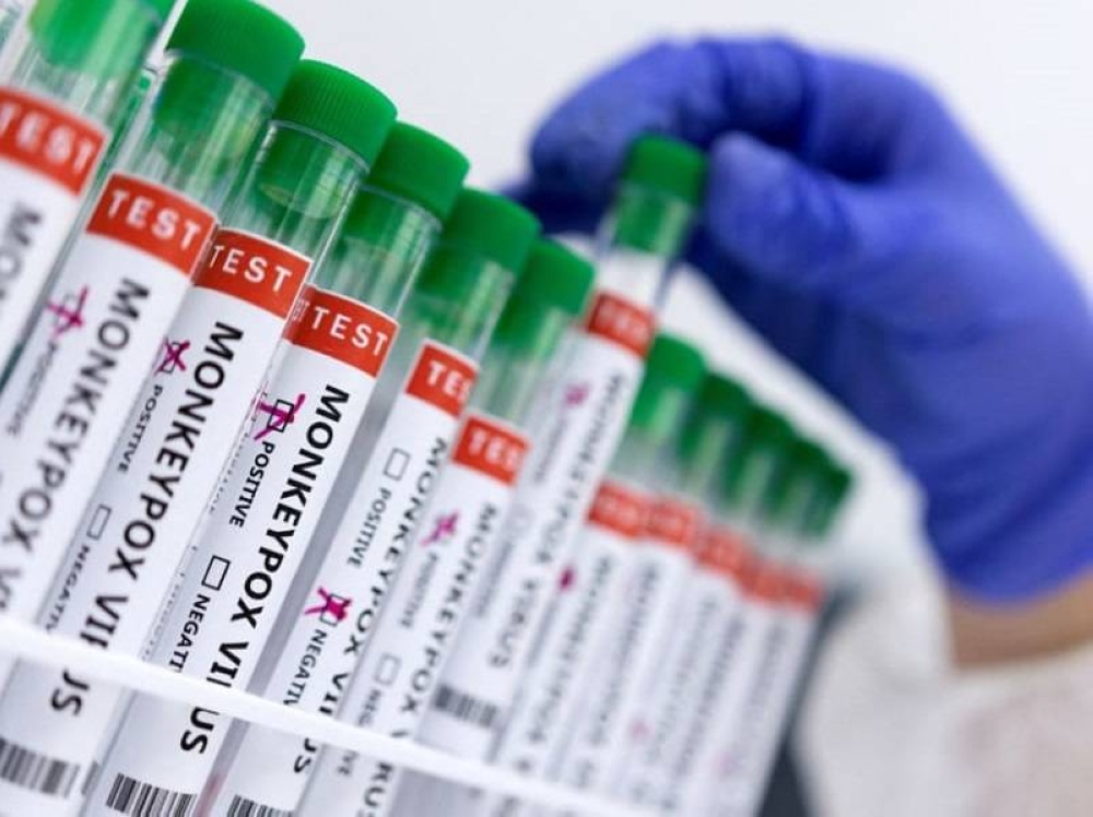 The media previously reported that the Thai government issued a national monkeypox warning after an emergency meeting of the health agency and public health minister on July 28. ― Reuters pic