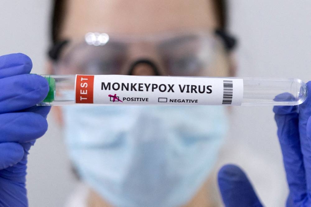 Belgium records first monkeypox death