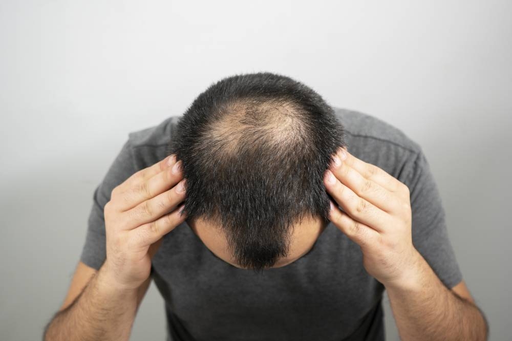 If you’re worried about hair loss, it could be time to quit sugary