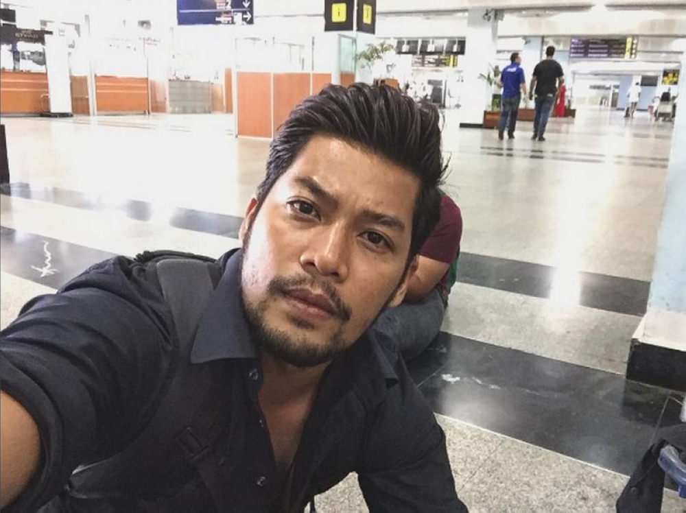 Malaysian celebrity Kamal Adli, who was injured after he was attacked by a man in Singapore late on Sunday night. — Picture courtesy of Instagram/Kamal Adli