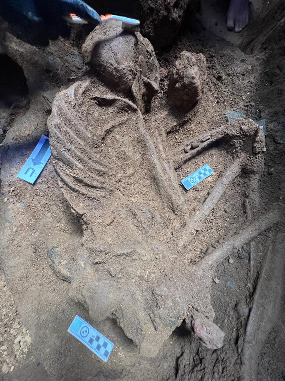 Archaeologists also used forensic dental studies to determine the age as human teeth that remain intact for years after death. — Bernama pic