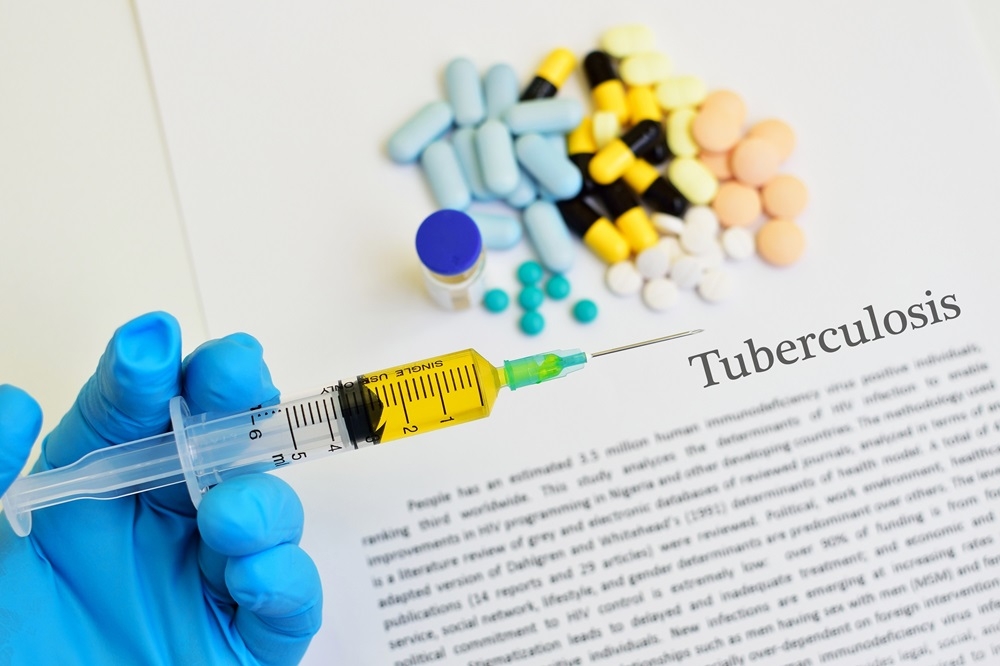 Tuberculosis is the second deadliest infectious disease, according to the World Health Organization, killing only slightly fewer people than Covid-19 last year. — jarun011/Getty Images/ETX Studio pic 