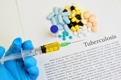 Common drug halves risk of drug-resistant tuberculosis, say researchers