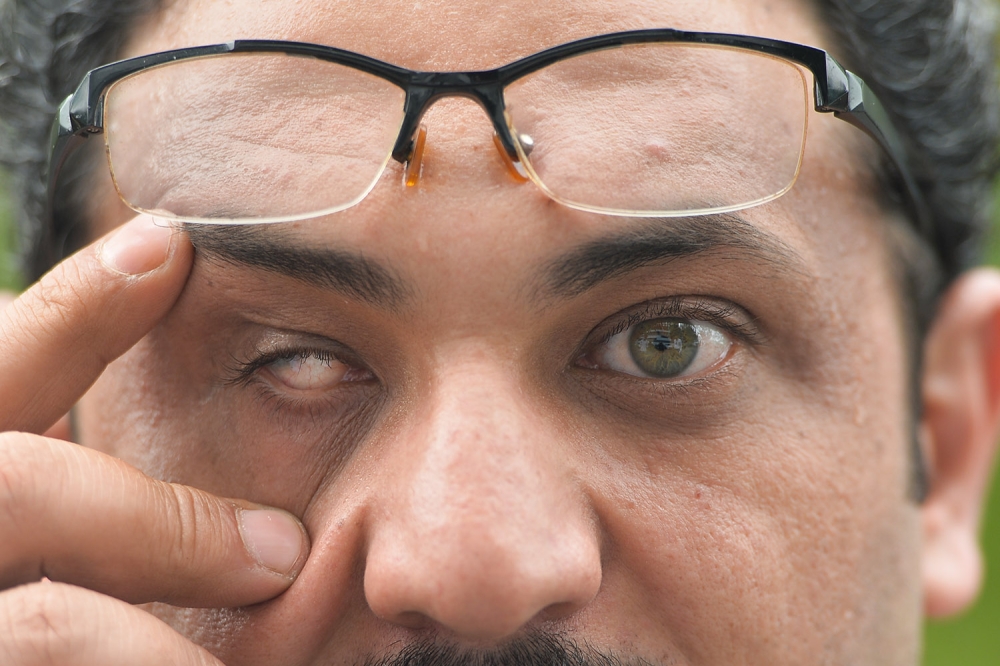Palestinian refugee Thaer Jihad Mohamad Mansur lost his eyes in the war back in 2006. — Picture by Miera Zulyana
