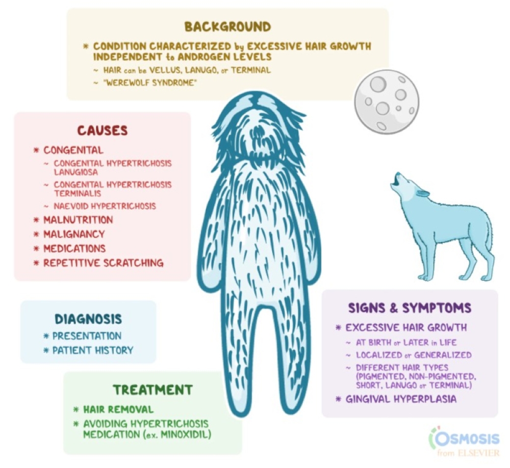 Osmosis, a medical education company, uses a drawing to explain the causes, diagnosis, treatment, signs and symptoms of Werewolf Syndrome. ― Graphic courtesy of Osmosis from Elsevier