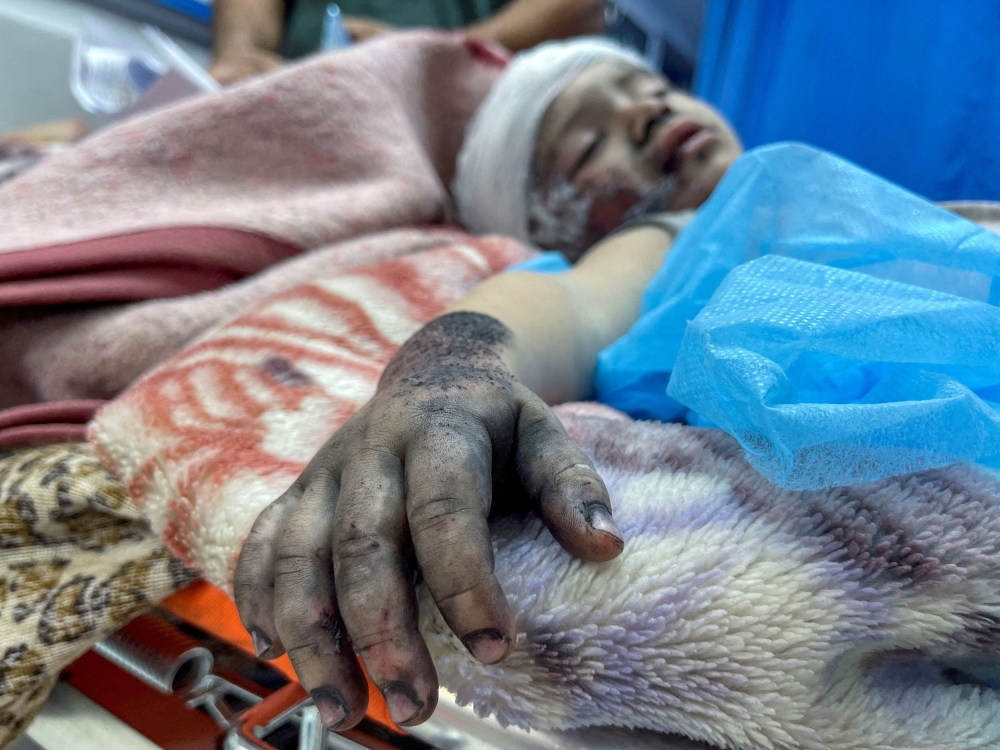A Palestinian boy, wounded in an Israeli bombing, lies on a bed at Shifa hospital in Gaza City. — Reuters pic