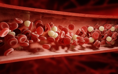 How genetic therapies transformed the lives of sickle cell patients