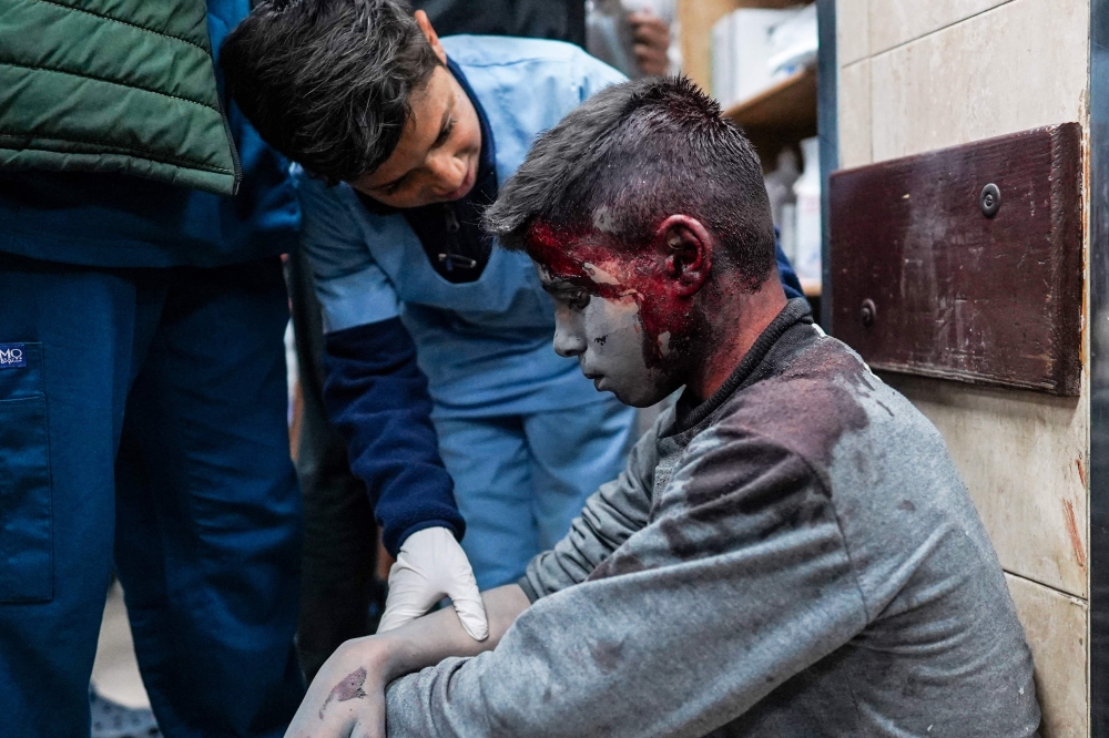 A wounded Palestinian boy waits for medical treatment at the Al-Aqsa Martyrs Hospital in Deir al-Balah on March 19, 2024, following Israeli bombardment in the Nuseirat refugee camp in the central Gaza Strip. — AFP pic