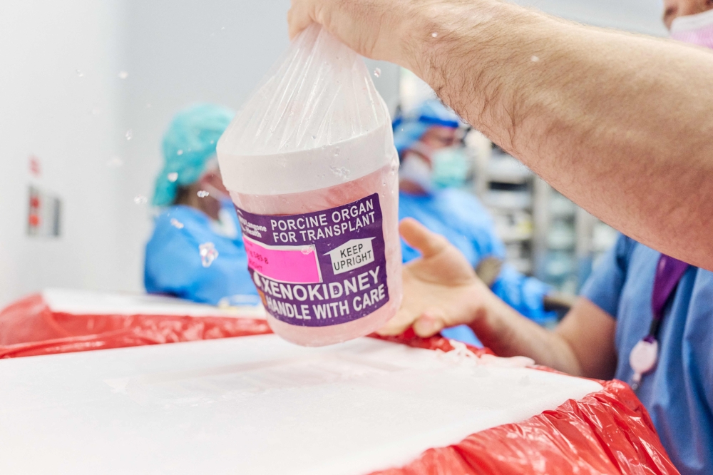 This image released by NYU Langone Health shows the gene-edited pig kidney being removed from its transport container, on April 12, 2024, in New York. — Joe CARROTTA / NYU Langone Health / AFP pic