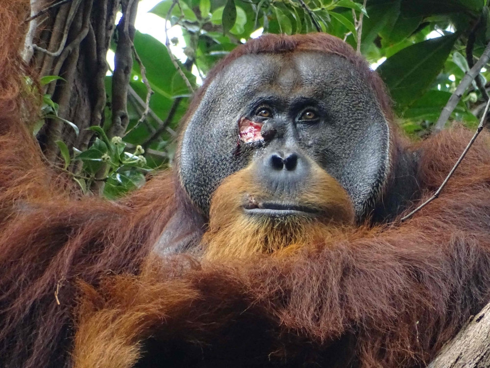 This handout photo released by SUAQ Foundation on June 23, 2022, shows Rakus, a male orangutan with a facial wound, at Gunung Leuser National Park in North Sumatra, Indonesia. Scientists have observed an orangutan applying medicinal herbs to a face wound in an apparently successful attempt to heal an injury, the first time such behaviour has been recorded. — SUAQ Foundation handout pic via AFP