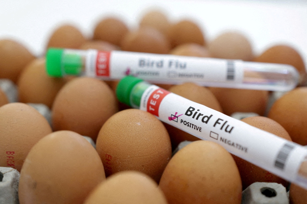 A man infected with H5N2 bird flu, the first confirmed human infection with the strain, died from multiple factors, the WHO said today, adding that investigations were ongoing. — Reuters pic