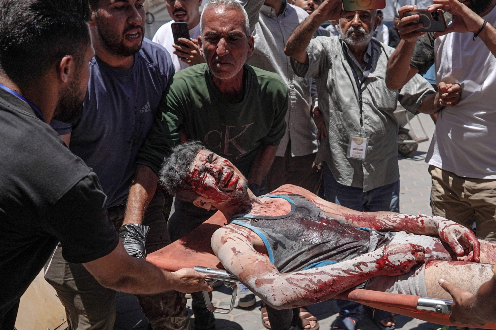 An injured youth is brought to the Al-Aqsa Martyrs Hospital in Deir al-Balah, after the Israeli bombardment of agricultural land in the area of al-Maghazi in the central Gaza Strip on June 11, 2024, amid the ongoing conflict between Israel and the Palestinian Hamas militant group. — AFP pic