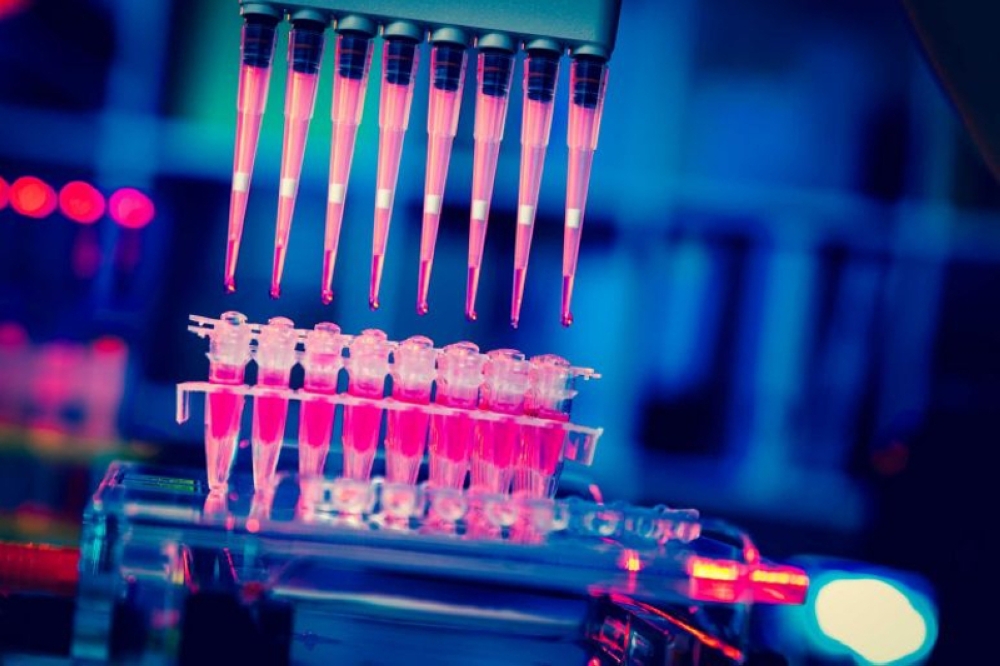 In a statement, Chemistry Malaysia said it had received the samples from the police, adding that the analysis of the blood samples would be expedited. — Picture by luchschen/Istock.Com via AFP