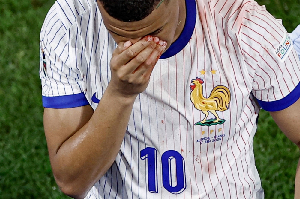Kylian Mbappe’s chances of playing for France against the Netherlands at the European Championship remain unclear, but if he does make it to the pitch in Leipzig, he will wear a protective mask after breaking his nose yesterday. — AFP pic