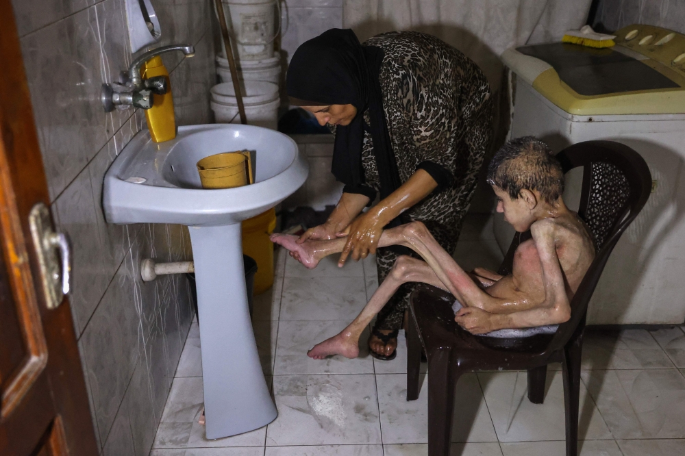 Sahar, mother of Palestinian man Bahaa al-Nimr , 19, who suffers from cerebral palsy and malnutrition, washes her son with little water in their home in the Sheikh Radwan neighbourhood in the north of Gaza City on July 2, 2024. More than 150,000 people in the Gaza Strip have contracted skin diseases in the squalid conditions into which displaced people have been forced since the Israel-Hamas war erupted in October, according to the WHO, while Gaza's children are already highly vulnerable to disease because their immune systems are compromised by malnutrition, the Doctors Without Borders (MSF) medical coordinator in the besieged Palestinian territory said. — AFP pic
