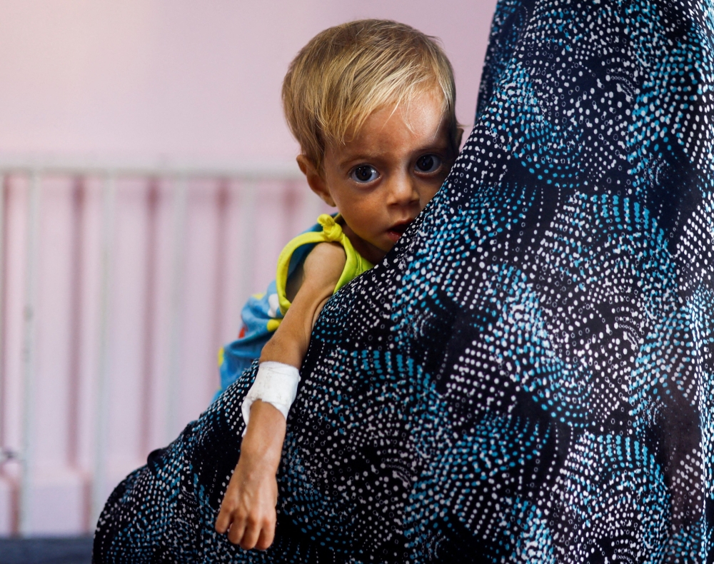 A child looks on at Nasser hospital in Khan Younis, in the southern Gaza Strip, July 8, 2024. — Reuters pic 