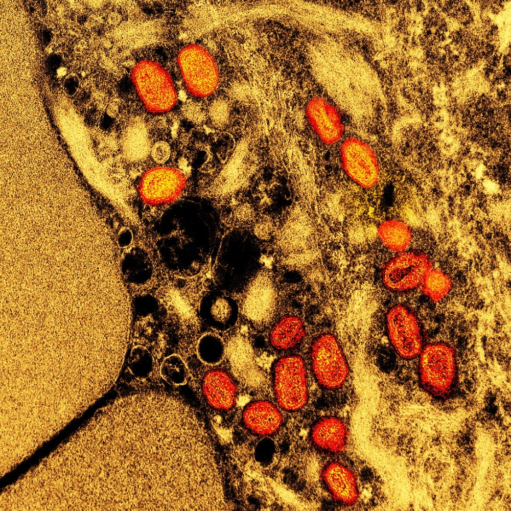 An undated colourised transmission electron micrograph of mpox virus particles (red) found within an infected cell (brown) cultured in the laboratory, captured at the National Institute of Allergy and Infectious Diseases (NIAID) Integrated Research Facility (IRF) in Fort Detrick, Maryland. — NIAID handout pic via Reuters 