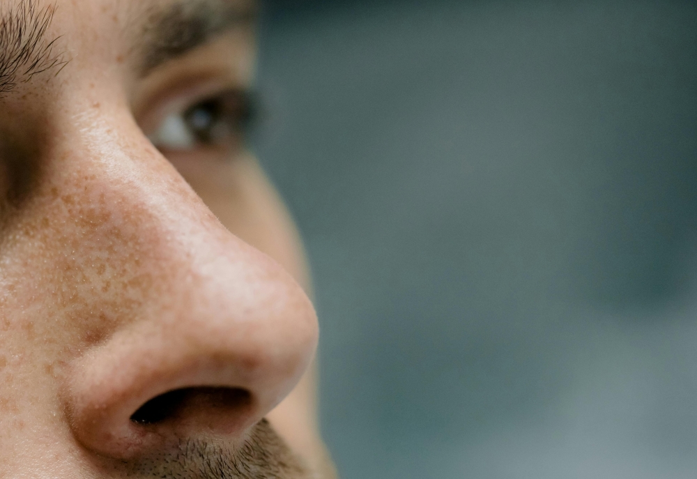 The accused is said to have caused injury by biting her neighbour's nose. — Stock pic via Pexels