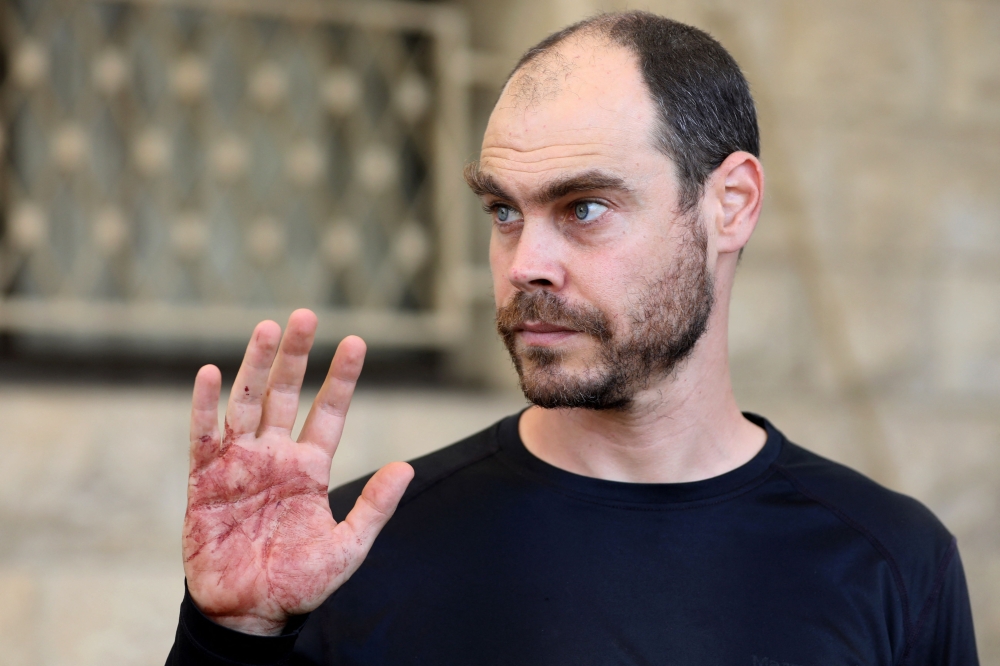 A colleague of Aysenur Ezgi Eygi, US-Turkish activist who died after reportedly being shot in the West Bank town of Beita, shows his blood-stained hand at a hospital in Nablus in the occupied West Bank on September 6, 2024. — AFP pic