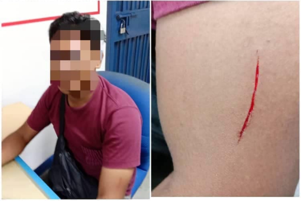 The 25-year-old man claimed he was attacked with a sharp weapon, believed to be a 'kerambit'. Of course, no such thing happened. — Picture from Facebook/Polis Kota Samarahan