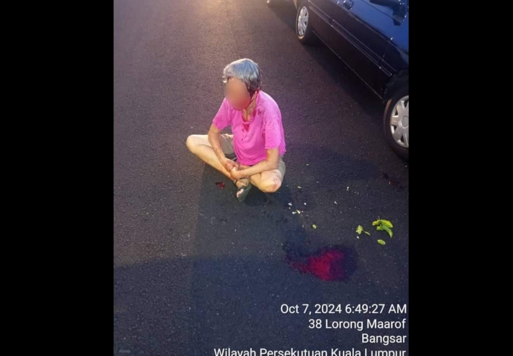 Brickfields District Police Chief ACP Ku Mashariman Ku Mahmood said the 78-year-old victim suffered severe bleeding and is currently receiving treatment at the University of Malaya Medical Centre. — Picture from social media