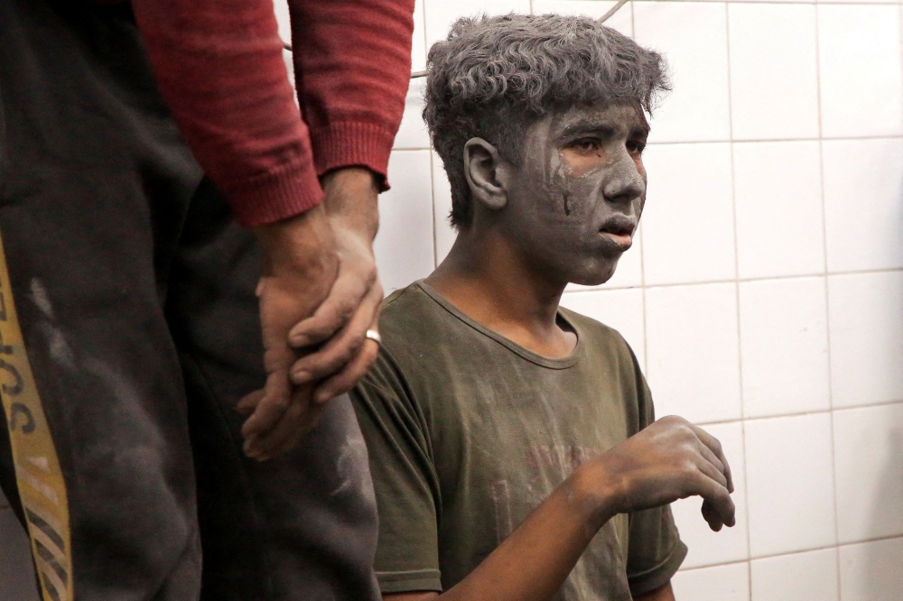 A Palestinian wounded in an Israeli strike looks on at Al-Ahli hospital, amid the ongoing Israel-Hamas conflict, in Gaza City, October 26, 2024. — Reuters pic