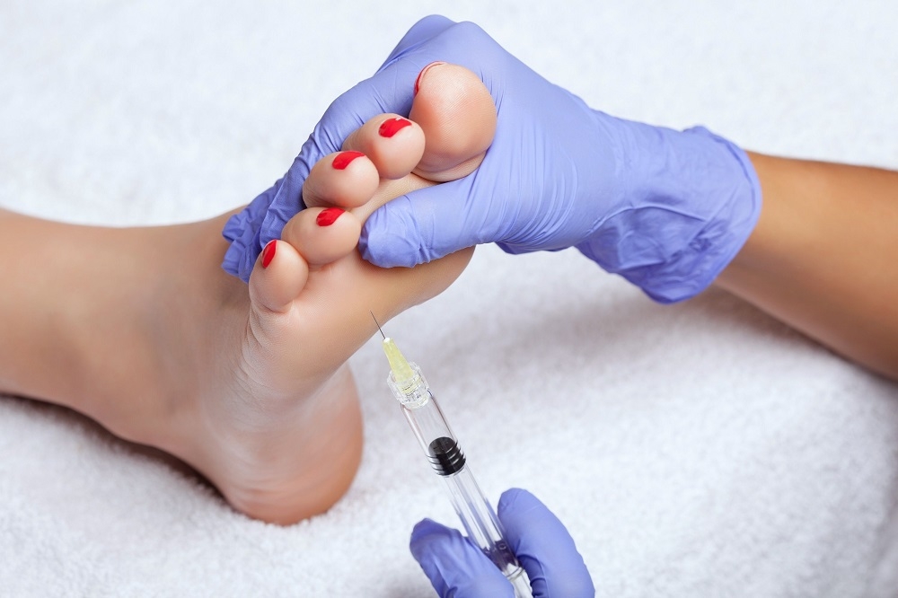 Foot Botox procedures have been on the rise post-pandemic. — ETX Studio pic