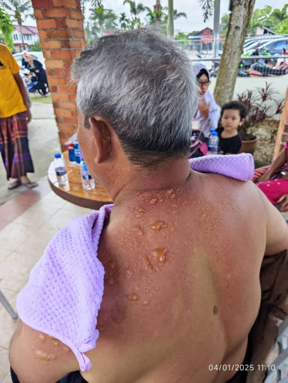 The victims sustained various degrees of injury and their conditions are still being monitored by medical personnel. — Picture via Facebook