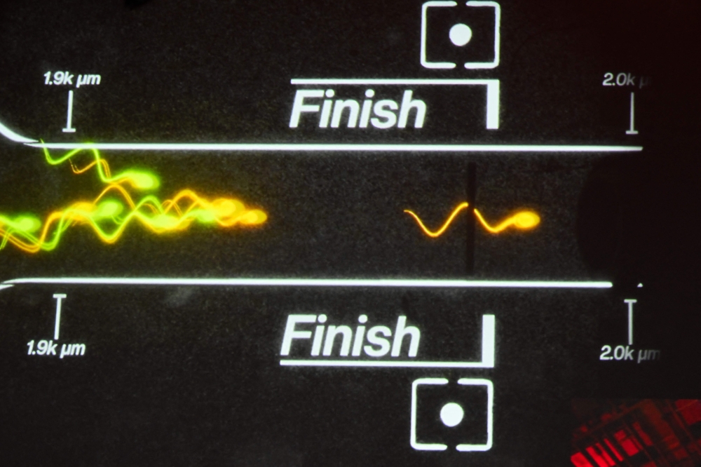A visualisation shows the sperm race finish line between Tristan Mykel of USC overtaking the Asher Proeger of UCLA in the Sperm Racing competition championship in Los Angeles. — AFP pic 