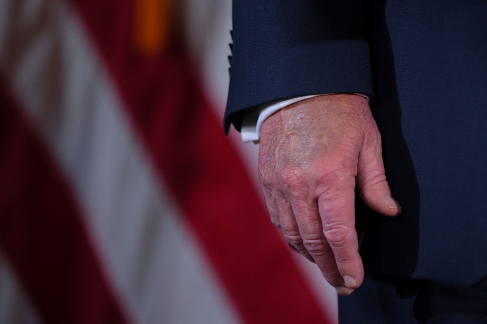 US President Donald Trump, 79, uses make-up to cover the back of his right hand, which was reported to have become swollen and bruised from too many handshakes. — Reuters pic