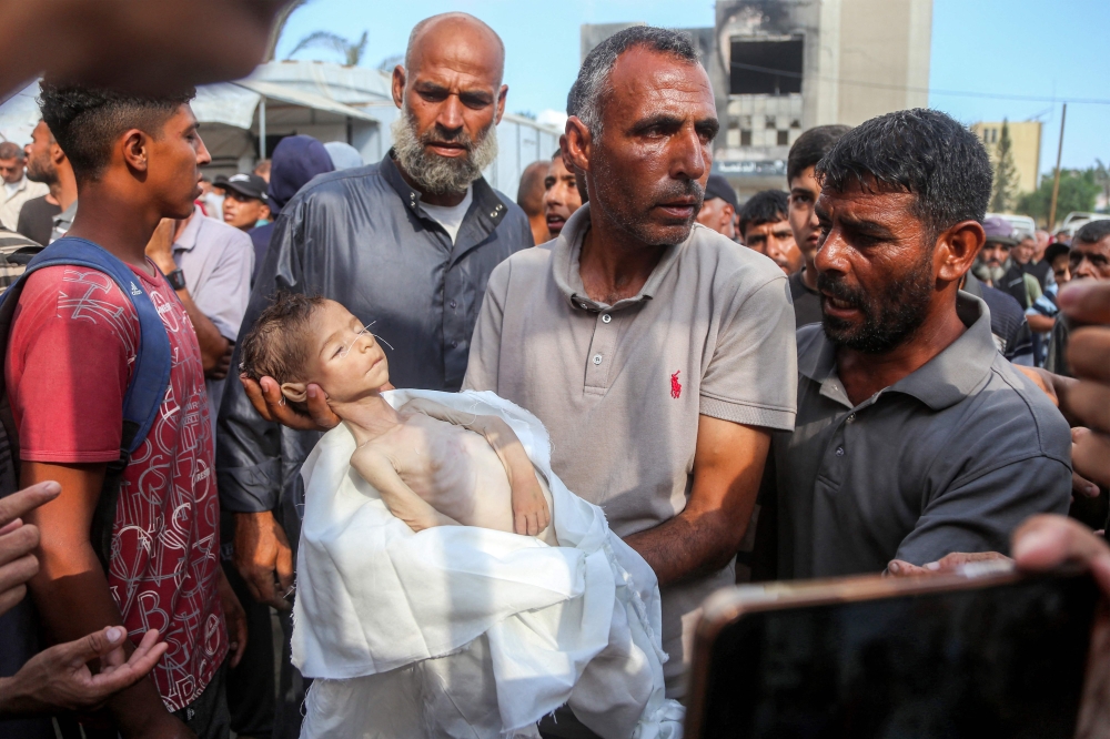 The father of Yahya Fadi al-Najjar, who died due to malnourishment, holds his body during the funeral at Nasser Medical Complex in Khan Younis in the southern Gaza Strip July 20, 2025. — AFP pic