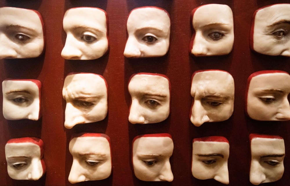 Wax mouldings of various eye diseases at the M?tter Museum Historical Medical Library, in Philadelphia. — AFP pic