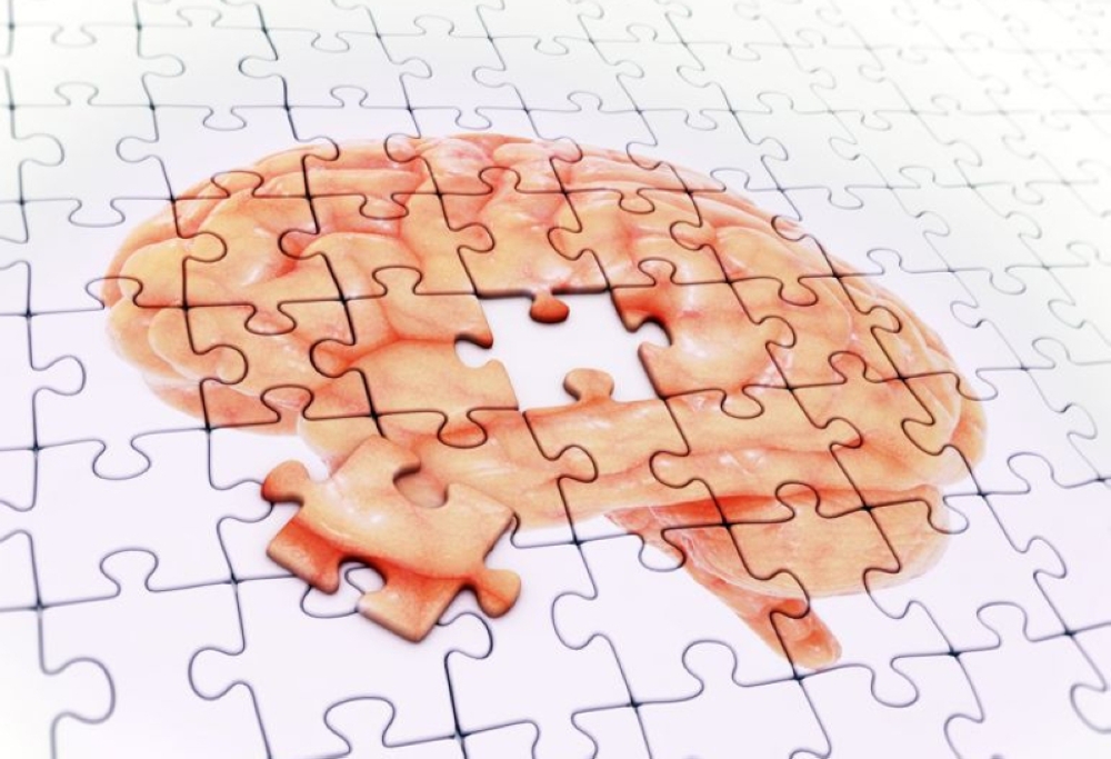 Malaysia currently has more than half a million people living with dementia. — AFP file pic