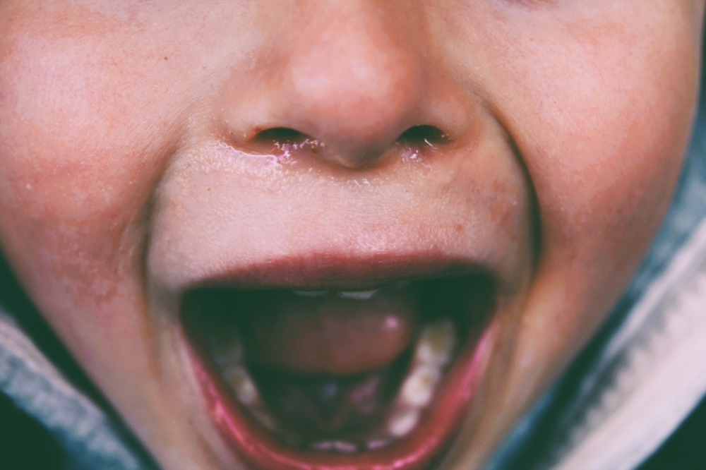 For young children, dental injuries from knocks or falls can cause fractures, loosened or even lost teeth, and may affect speech and nutrition if untreated. — Unsplash pic