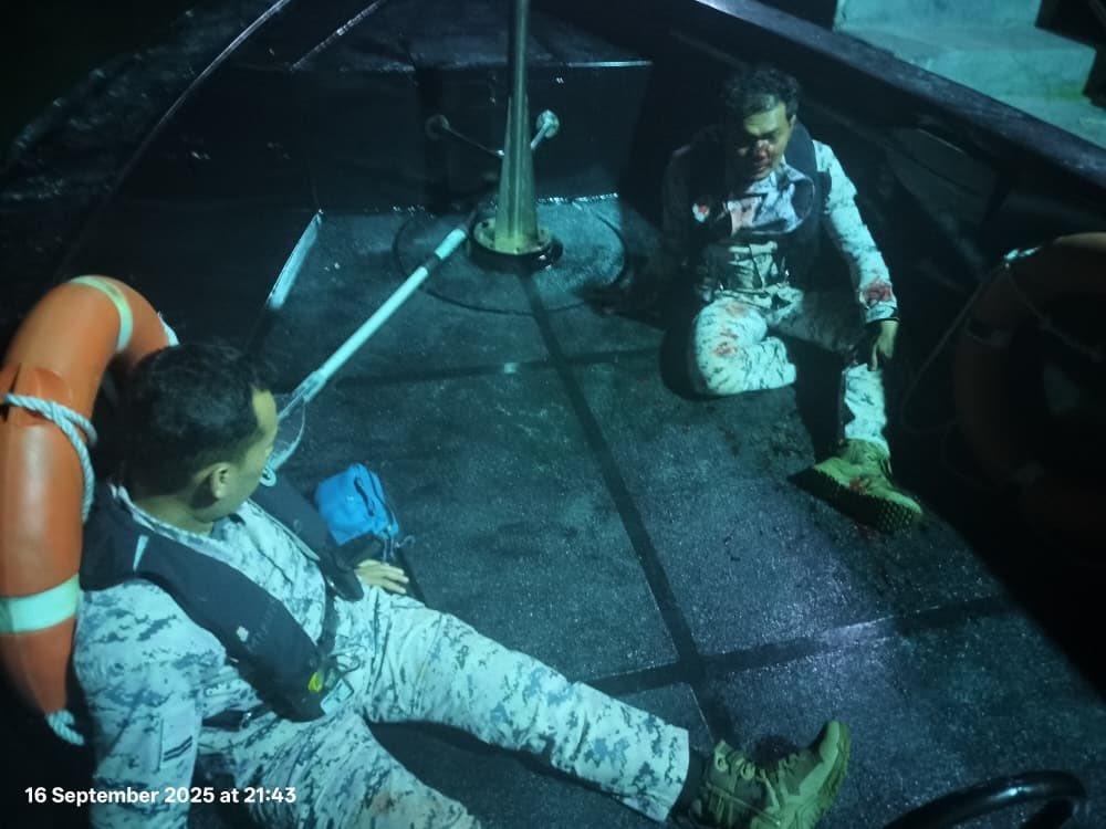 In the incident on Tuesday, one MMEA officer suffered injuries to his nose (right) while another was hurt on his legs and hands (left). — Picture via Facebook/maritimmalaysia