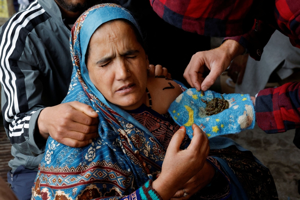 A patient receives leech therapy for her fractured shoulder at a makeshift clinic in Srinagar. — Reuters pic