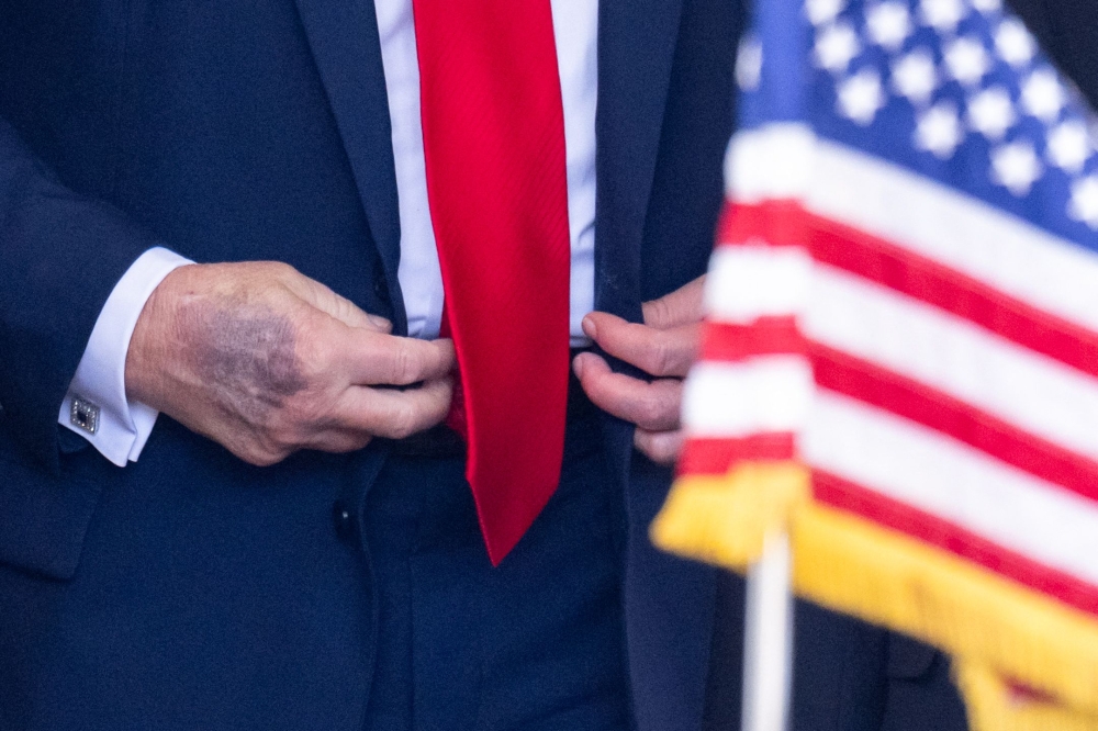 Close view of Trump’s hand as he greets South Korean President Lee Jae Myung at the White House, August 25, 2025. — AFP pic