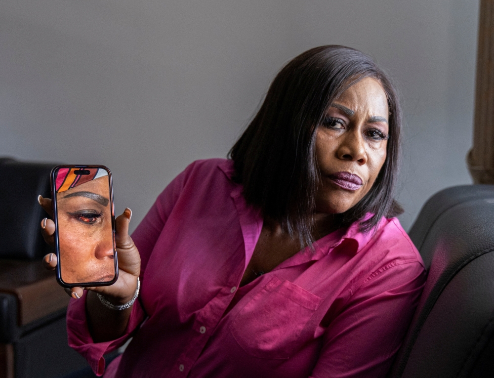 Rabbiatu Kuyateh shows a photograph on her mobile phone of her bloodshot eye which she has told Reuters was an injury sustained during deportation, December 4, 2025. — Reuters pic
