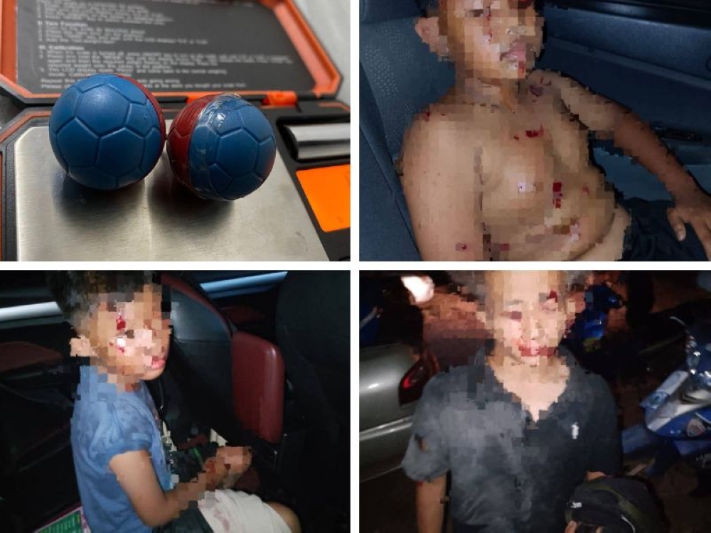 A ‘mercun bola’ firecracker, similar to the one said to have been used in the incident that purportedly injured several people on the eve of Hari Raya Puasa in Tobiar, Pendang on March 20, 2026, as Kedah police seek to verify claims of a firecracker mishap. — Pictures from Facebook/Farid Qasya MD/Asal Jujur