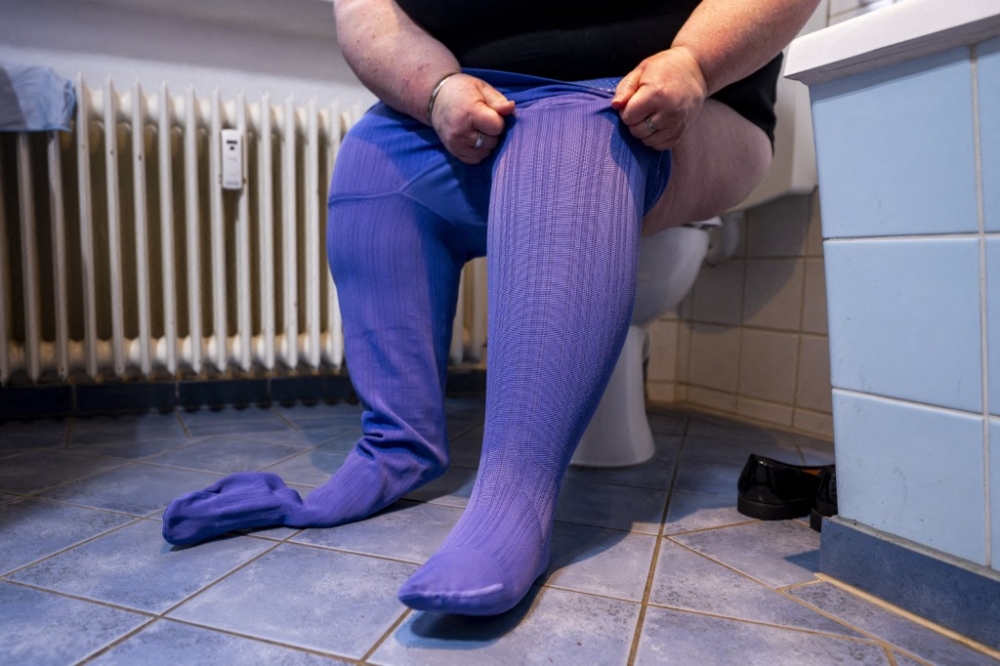 ‘I tried every diet’: What is lipoedema? Women describe life with the little‑known chronic fat disorder