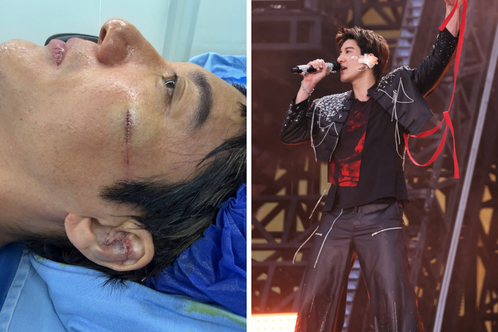 Show must go on: Mandopop star Wang Leehom takes heavy fall onstage but keeps singing, 39 stitches later (VIDEO)