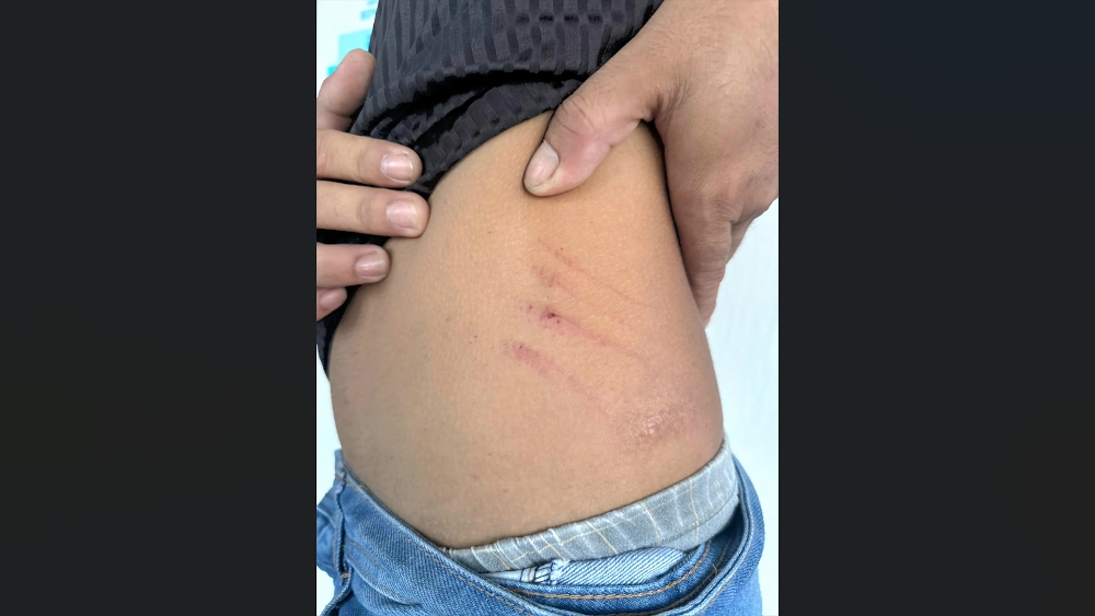 Sarawak housewife held after alleged scissor attack on husband who refused divorce
