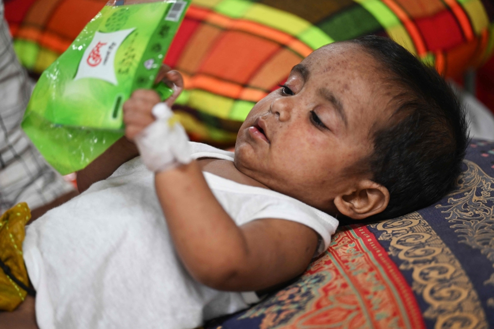 A child with measles is seen at Bangladesh Shishu Hospital & Institute in Dhaka on September 3, 2026, as hospitals struggle to cope with a surge in cases among young children. — AFP pic